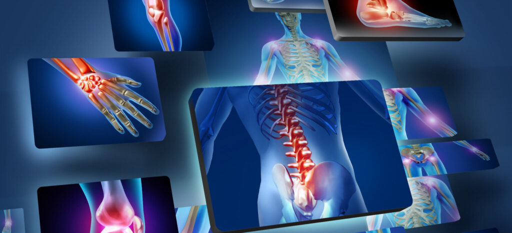 Physiotherapy for neck pain in Nashik